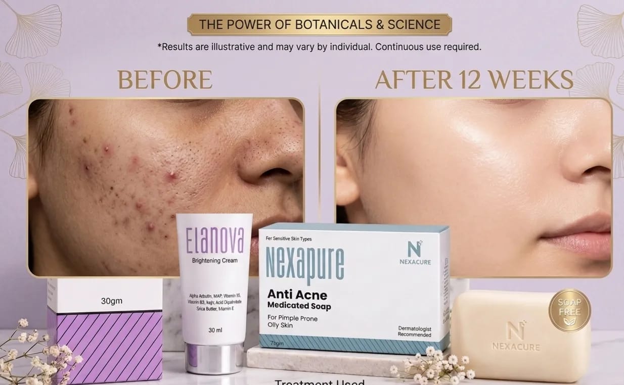 BUNDLE( CREAM,SOAP)