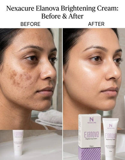ELANOVA BRIGHTENING CREAM